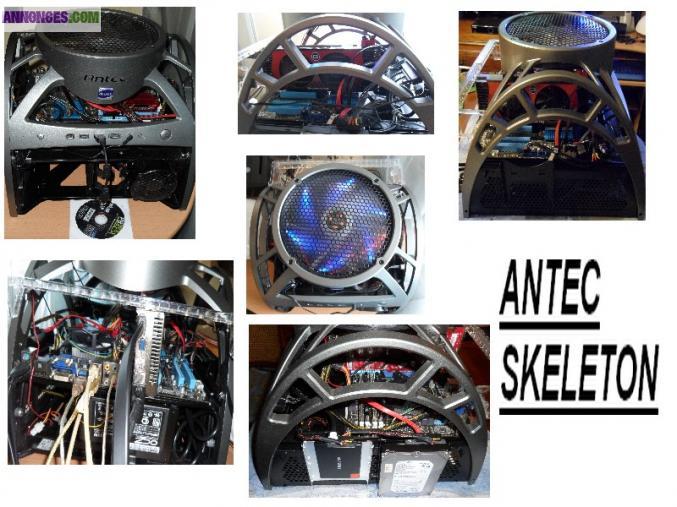 UC SKELETON ASSEMBLEE avec SSD