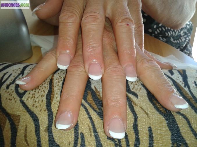 Prothesiste ongulaire