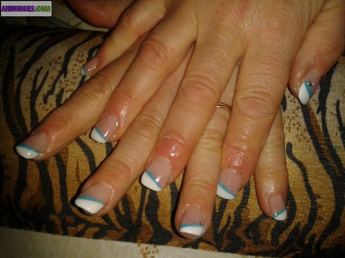 Prothesiste ongulaire