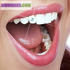 Bijoux dentaires
